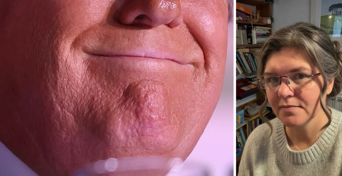 Läppläsaren om Trumps ord i mötet med Charles